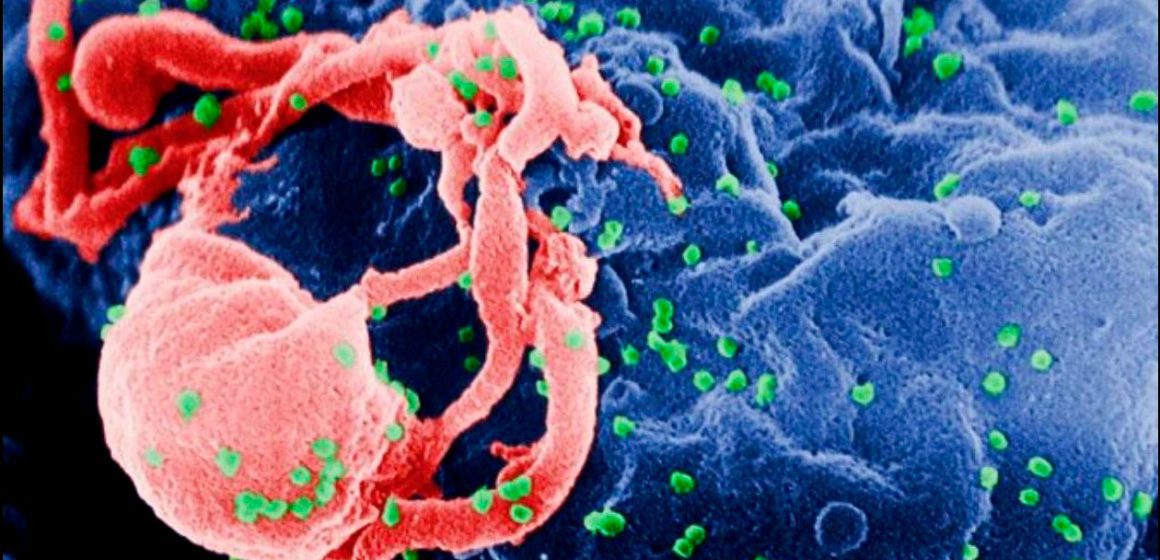 El lugar donde comenzó la pesadilla del VIH y cómo terminó propagándose en todo el mundo